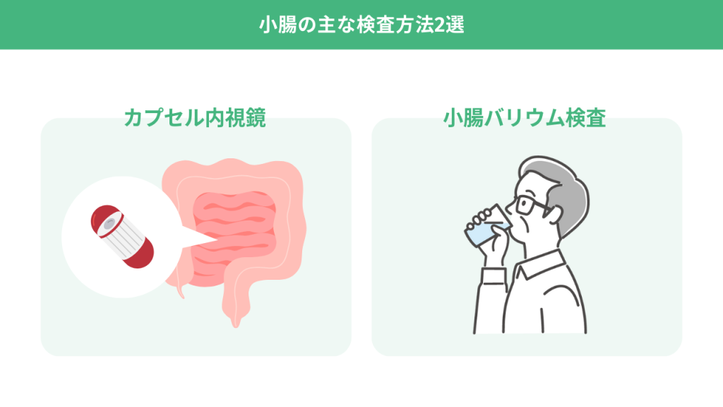 小腸検査は必要ない？主な検査方法2選